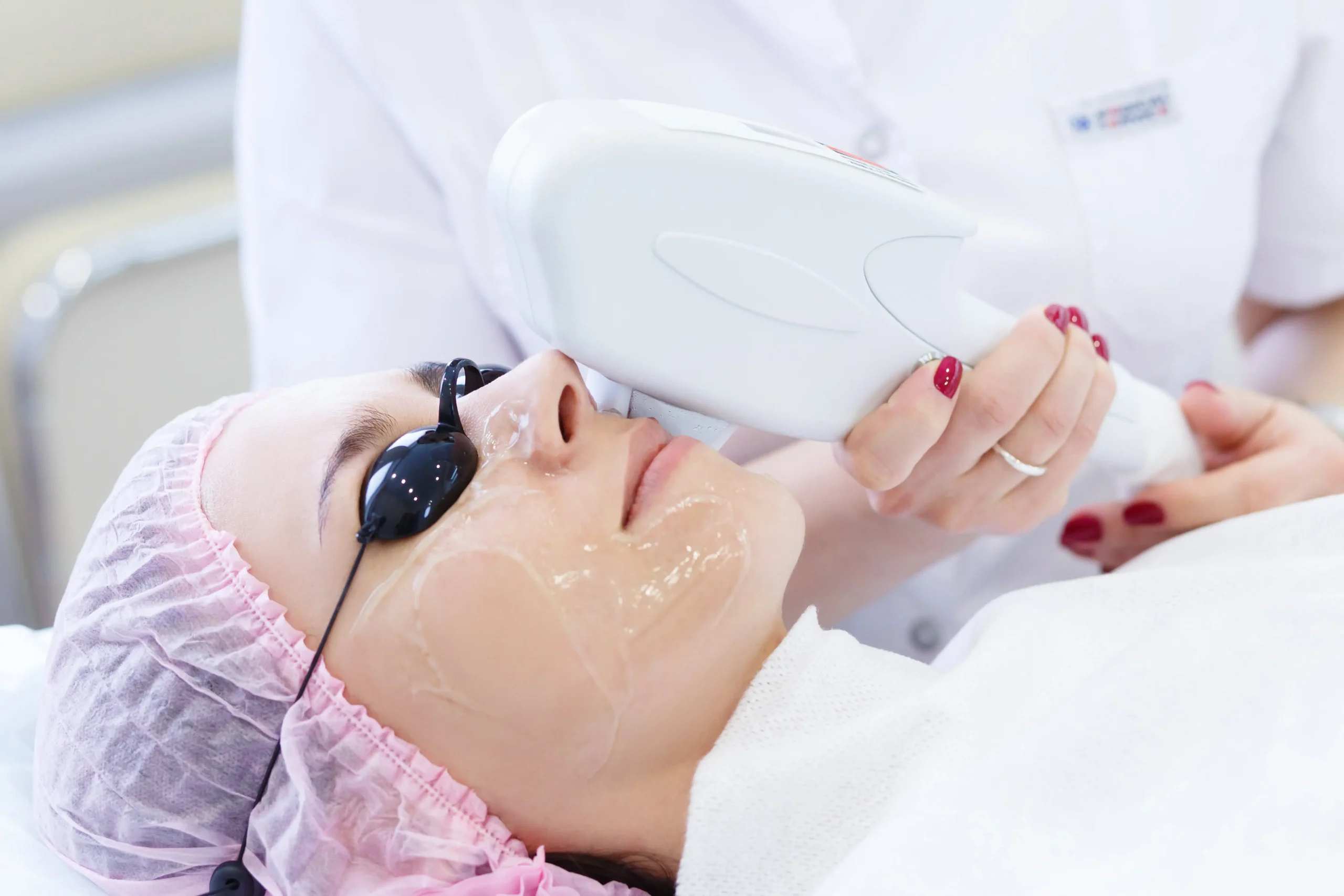 Laser photofacial By Sculpt Aesthetics in Idaho