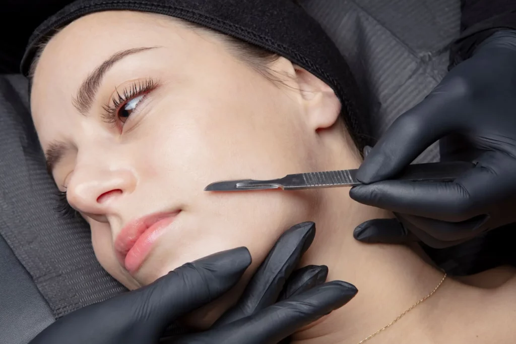 Dermaplaning Treatment in Meridian, ID - Sculpt Aesthetics